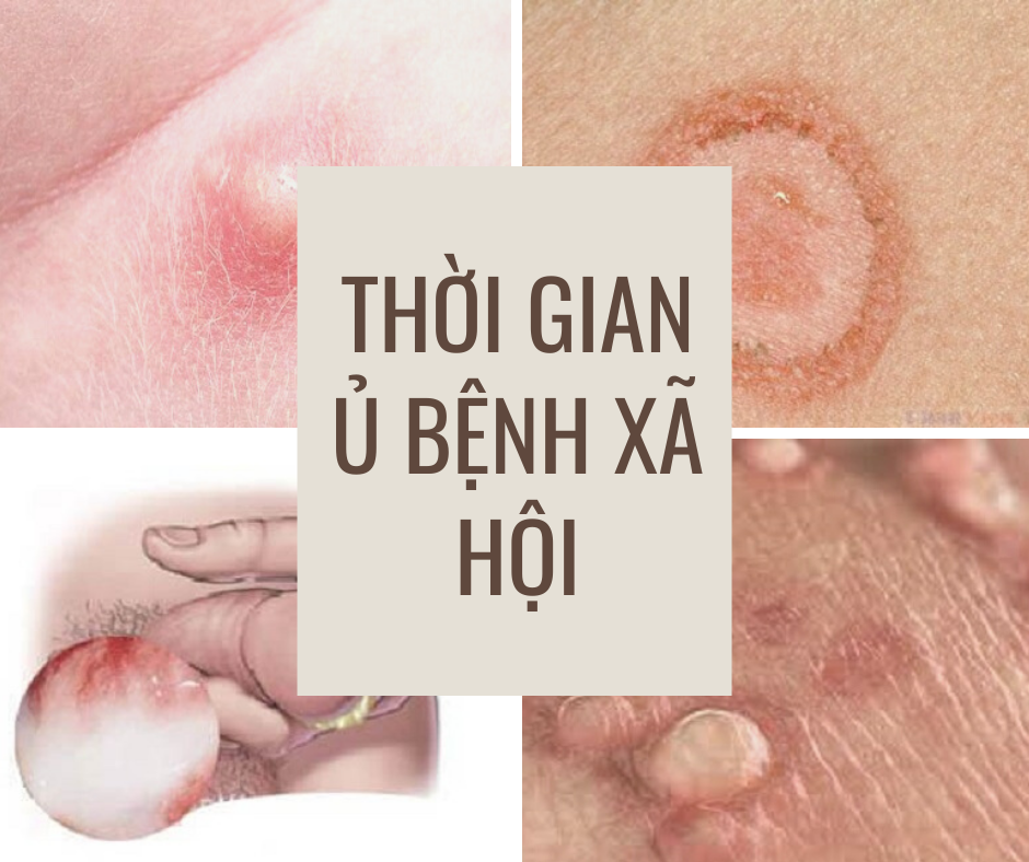 Bệnh xã hội gây ngứa vùng kín