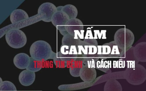 Viêm nấm âm đạo: Dấu hiệu nhận biết và cách điều trị