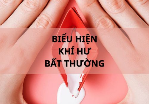 Biểu hiện khí hư bất thường: Dấu hiệu cảnh báo bệnh lý phụ khoa