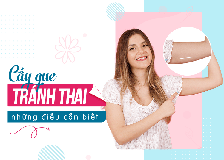 Cấy que tránh thai: Lựa chọn an toàn cho chị em phụ nữ