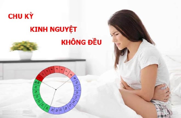 trễ kinh cũng là một biểu hiện của tình trạng kinh nguyệt không đều