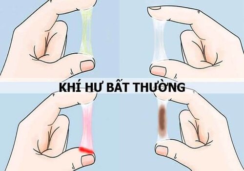 Vùng kín ra khí hư bất thường có nguy hiểm gì không?