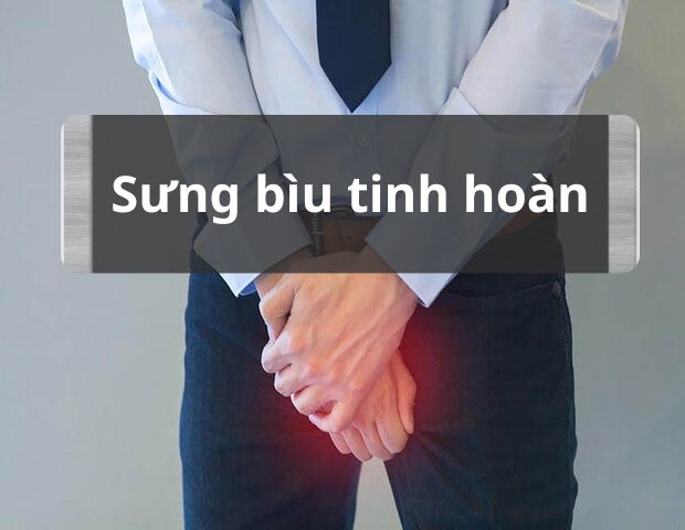 Sưng bìu tinh hoàn có đáng lo? Những điều nam giới cần biết