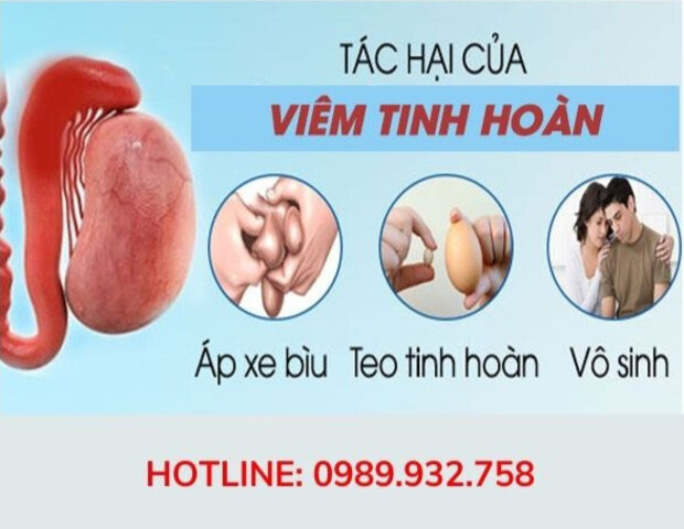 viêm tinh hoàn nên điều trị sớm để tránh biến chứng