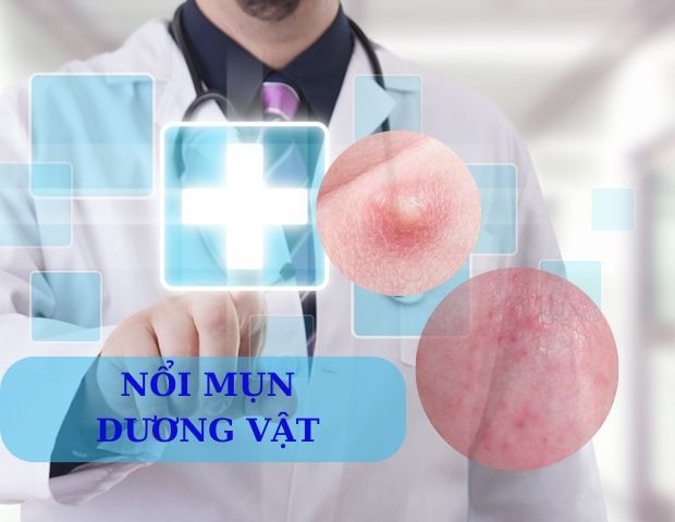 Tại sao lại có hiện tượng nổi mụn dương vật bất thường?